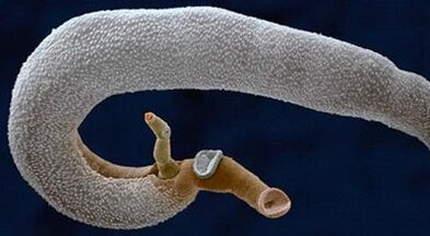 Was Parasiten im menschlichen Magen leben können