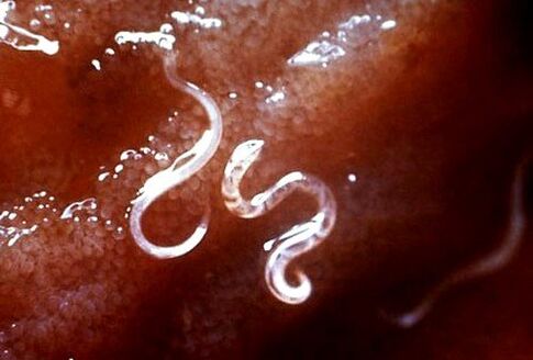 Parasiten im Körper