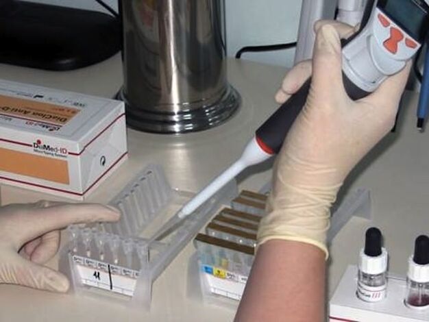 Labortests zur Diagnose parasitärer Erkrankungen
